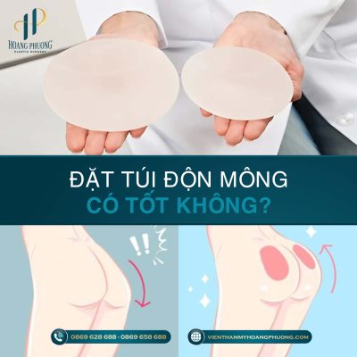 Đặt túi độn mông có tốt không?