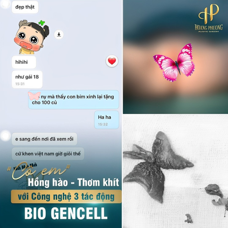 Feedback khách hàng sau khi tân trang cô bé tại Thẩm Mỹ Hoàng Phương